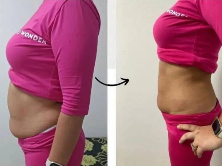 Before / After: A more defined abdomen